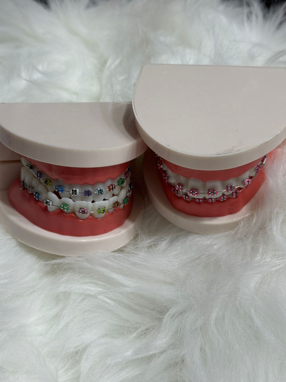 Braces